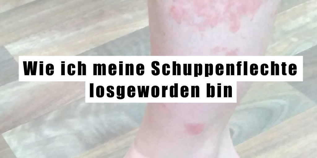 Wie ich meine Schuppenflechte losgeworden bin